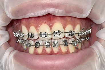 Orthodontic Dentistry